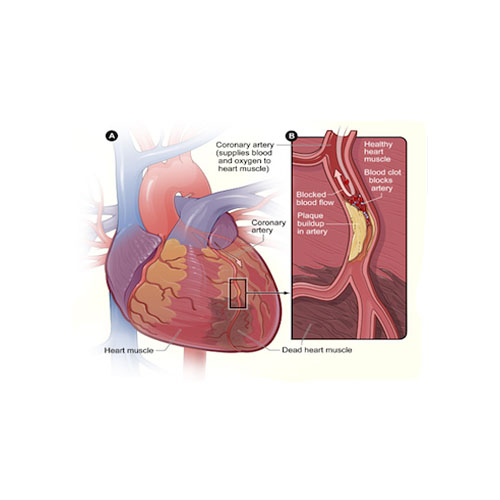 Hormones/Anticoagulant/ </br>Hemostatic